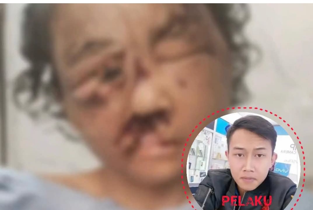 Tiga Tahun Disekap Pacar, Seorang Perempuan di Bandung Ditemukan dalam Kondisi Tragis